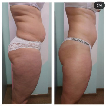 Оксана Соколовська, Ирпень Фото - 27