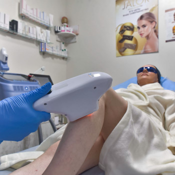 Лазерна епіляція. Elos.