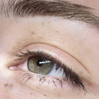 Фото до процедури ламі.