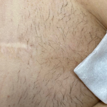 Ілона Осаволюк, Київ Фото - 7