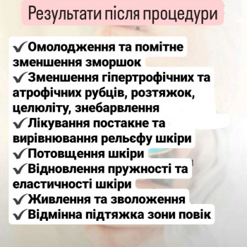 Мезотерапія
                    Салон краси Імперія краси Кременчук