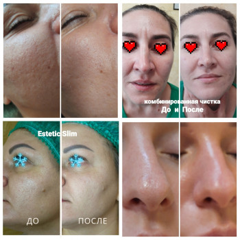  
До и после чистки.