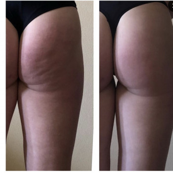 Анна Камінська, Киев Фото - 6