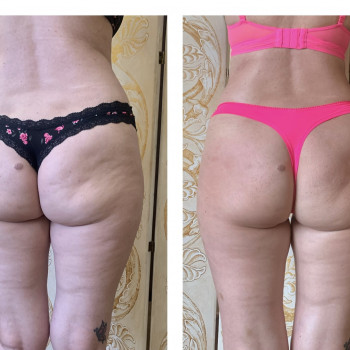 Анна Камінська, Киев Фото - 9