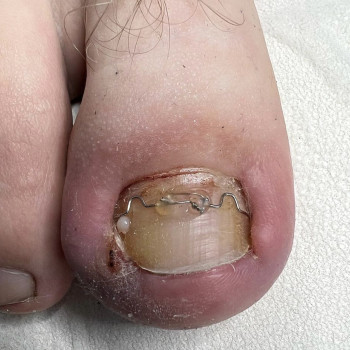 Корекційна система 3ТО