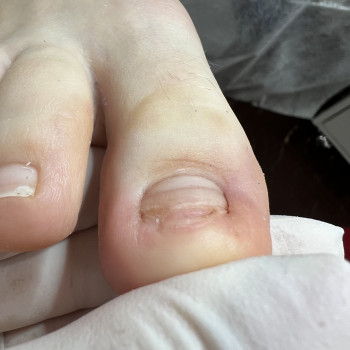 Після обробки