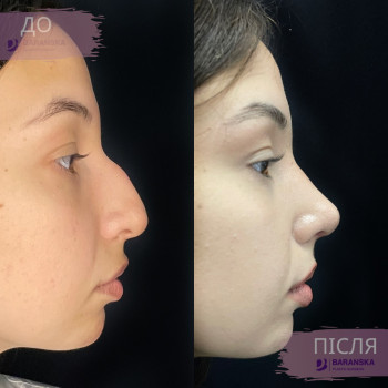 Запис за тел