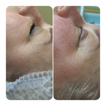 Анна Юрьєва, Одеса Фото - 17