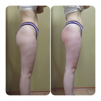 Анна Юрьєва, Одеса Фото - 13