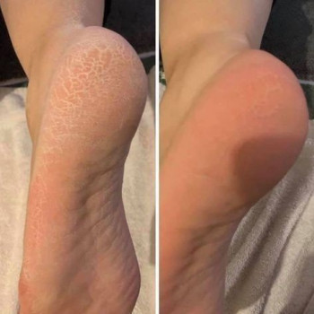 Окcана Павлова, Ужгород Фото - 8