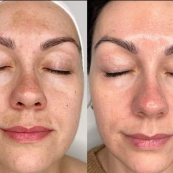 Окcана Павлова, Ужгород Фото - 3