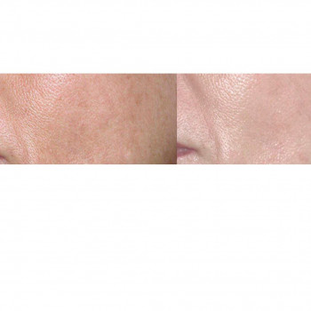 Пілінги SweetSkin
                    Косметологический центр  Киев