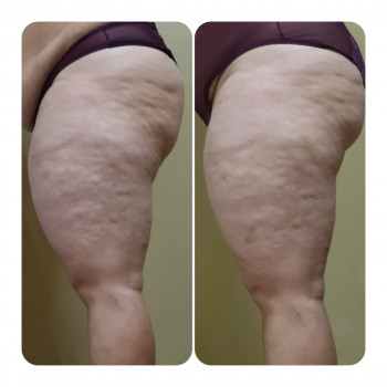 Анна Юрьєва, Одеса Фото - 41