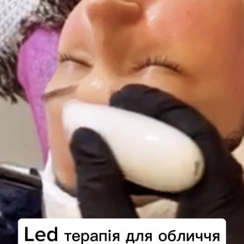 Led терапія для обличчя
                    Салон красоты Імперія краси Кременчуг