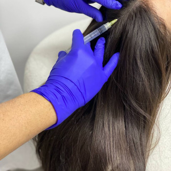 Покращення стану шкіри голови та волосся - великий вибір пре