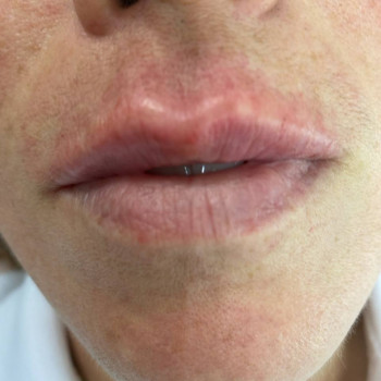 Губки люблять живлення