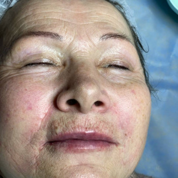 процедури краси не мають вікових обмежень