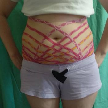 Лімфодренаж живота. Схуднення., фото - кінезітерапевт Наталія Денисова