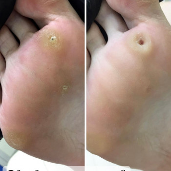 Наталья Балаховская, Кременчуг Фото - 88