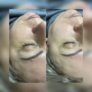 Вікторія Доценко, Кривий Ріг Фото - 3