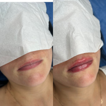 Катерина Огороднік, Київ Фото - 10