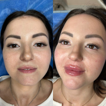 Катерина Огороднік, Київ Фото - 12