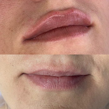 Катерина Огороднік, Київ Фото - 16