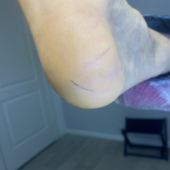 Обробка тріщин
                    Подолог Анна Днепр