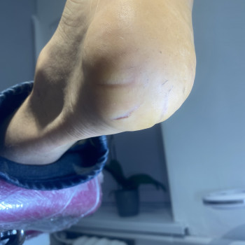 Обробка тріщин
                    Подолог Анна Днепр