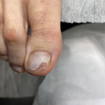 Протезування
                    Подолог Анна Днепр