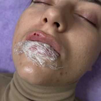 Фото з портфоліо косметолога Олена Савіна (Одеса)