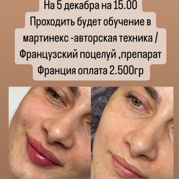 Фото з портфоліо косметолога Олена Савіна (Одеса)