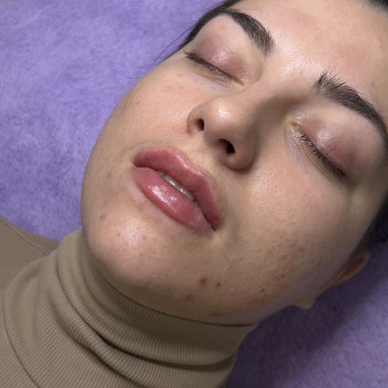 Фото з портфоліо косметолога Олена Савіна (Одеса)