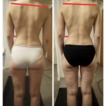 Лечебный глубокомышечный массаж (женщины и дети от 6 лет)/Общий оздоровительный массаж
                    Массажист Ирина Днепр