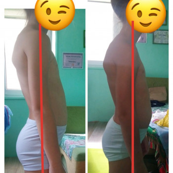 Лікувальний масаж та ЛФК для дітей і дорослих при порушенні постави / Лечебный массаж и ЛФК  для детей и взрослых при нарушении осанки
                    Массажист Ирина Днепр