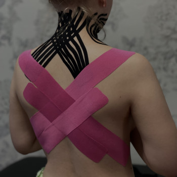 Тейпування осанки та холки