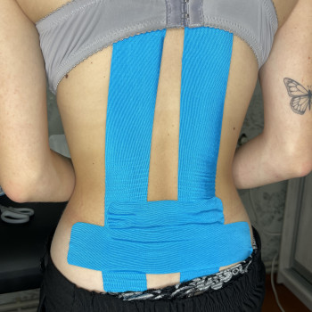 Тейпування проти болю в поясниці