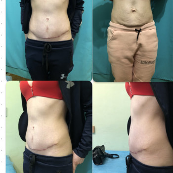 Тарас Било, Тернополь Фото - 1