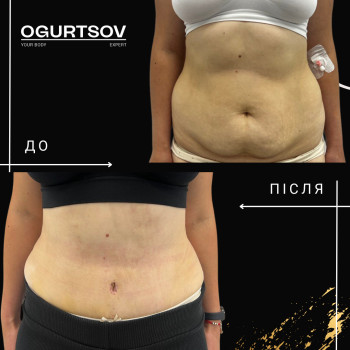 Олексій Огурцов, Львов Фото - 6