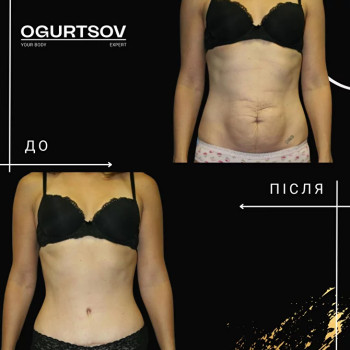 Олексій Огурцов, Львов Фото - 8