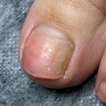 Елена Олеговна Хавер, Черкассы Фото - 25