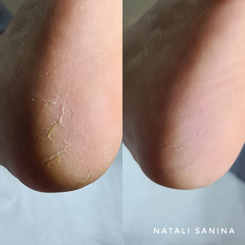 Наталия Санина, Киев Фото - 78