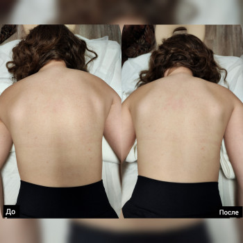 Восстановления пастурального баланса