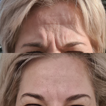 Катерина Онищук, Житомир Фото - 4