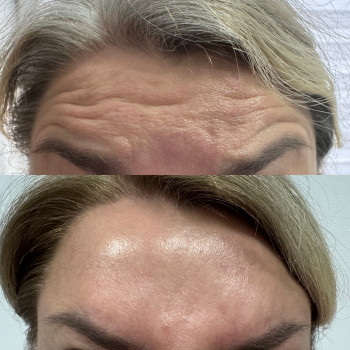 Катерина Онищук, Житомир Фото - 3