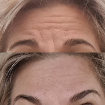 Катерина Онищук, Житомир Фото - 18