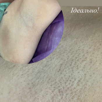 Лазерне видалення волосся
                    Майстер манікюру Анна Запоріжжя