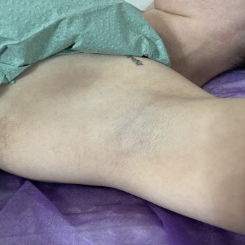 Лазерне видалення волосся
                    Майстер манікюру Анна Запоріжжя