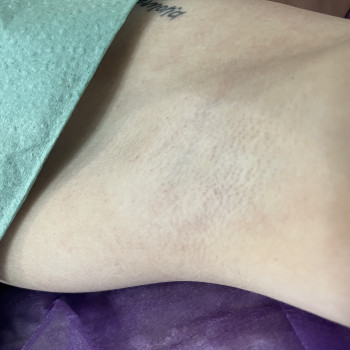 Лазерне видалення волосся
                    Майстер манікюру Анна Запоріжжя