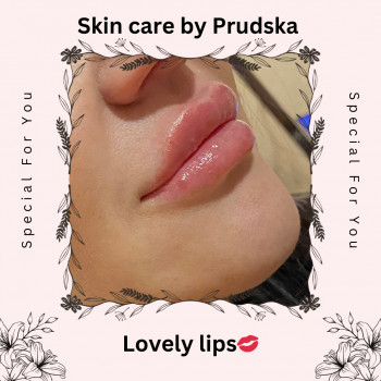 Вера Прудская, Бровары Фото - 30